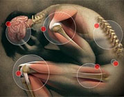 Tratamento de Dor em Jaú